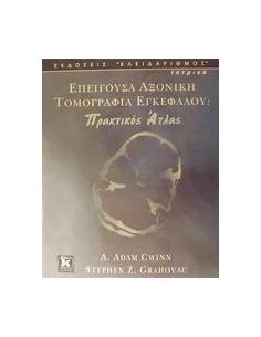 ΕΠΕΙΓΟΥΣΑ ΑΞΟΝΙΚΗ ΤΟΜΟΓΡΑΦΙΑ ΕΓΚΕΦΑΛΟΥ 2