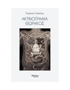 ΑΚΤΙΝΟΓΡΑΦΙΑ ΘΩΡΑΚΟΣ