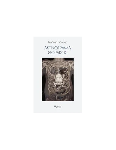 ΑΚΤΙΝΟΓΡΑΦΙΑ ΘΩΡΑΚΟΣ